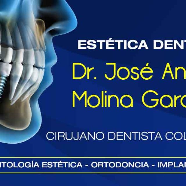 ESTÉTICA DENTAL MOLINA GARCÍA